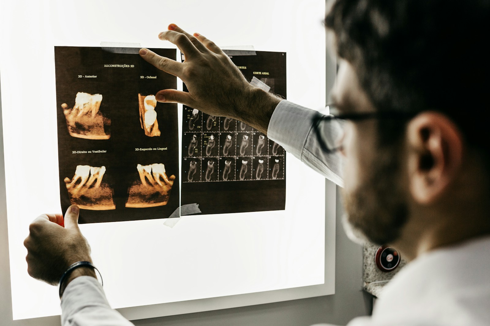 Exoplan / CBCT: 3D çene ve implant yönelimi