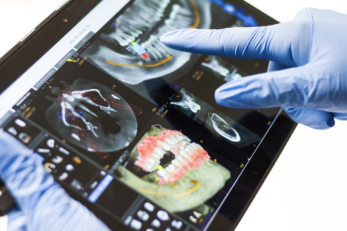 Dijital CAD planlama: CBCT ve 3D model ekranı
